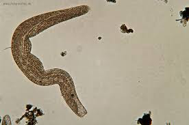 Clasifică nemathelminthes hewan Platyhelminthes kelas cestoda.