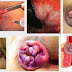 Obat Untuk Ambeien Ringan thumbnail