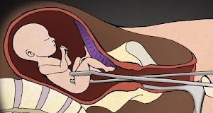 Ils déchirent le corps puis ils font sortir la tête du bébé : voici ce qui se passe au corps du bébé pendant l’avortement (vidéo choquante) !