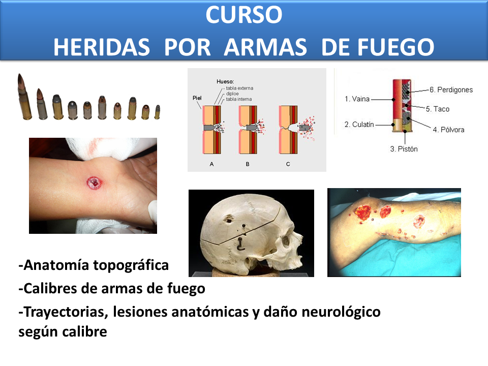 BREA VENENOS CURSO DE HERIDAS POR ARMAS DE FUEGO BREA VENENOS CURSO DE HERIDAS POR ARMAS DE FUEGO