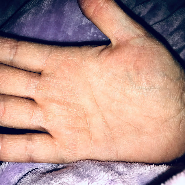 Mein Absoluter Geheimtipp Bei Trockener Rissiger Haut Sarahs Bunte Welt