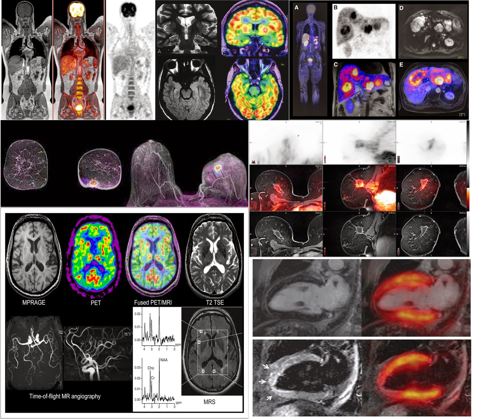 MRI and Medical Imaging MR/PET current status in clinical routine and