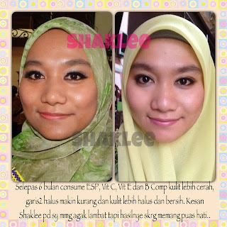 Testimoni vitamin E Shaklee