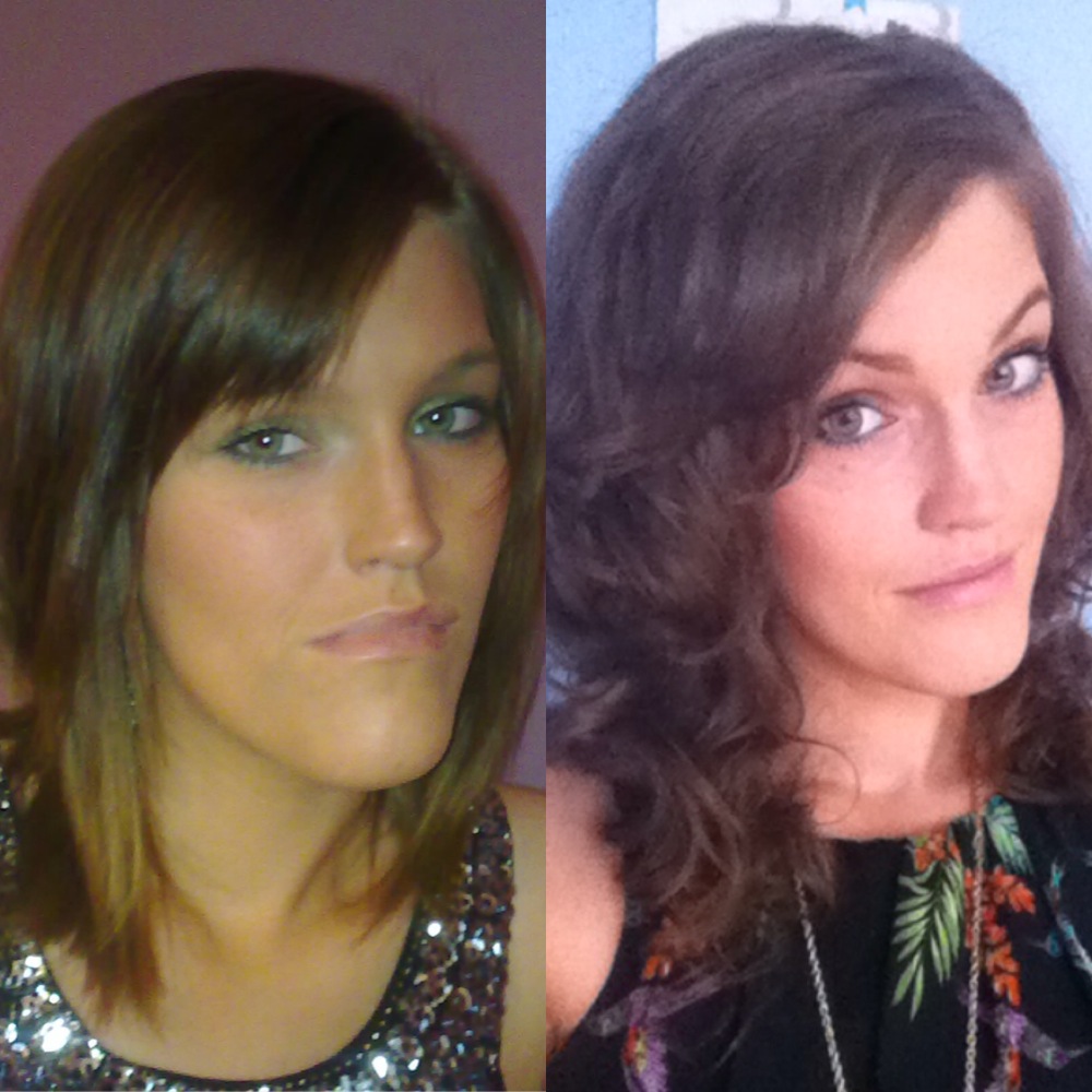 A Guide to Surviving Orthognathic Surgery Working with Saving Faces