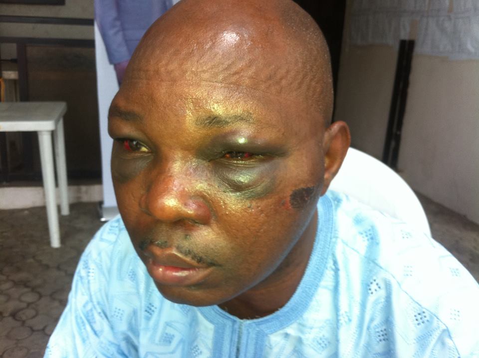 journalist beaten to coma customs seme border journalist beaten to coma customs seme border