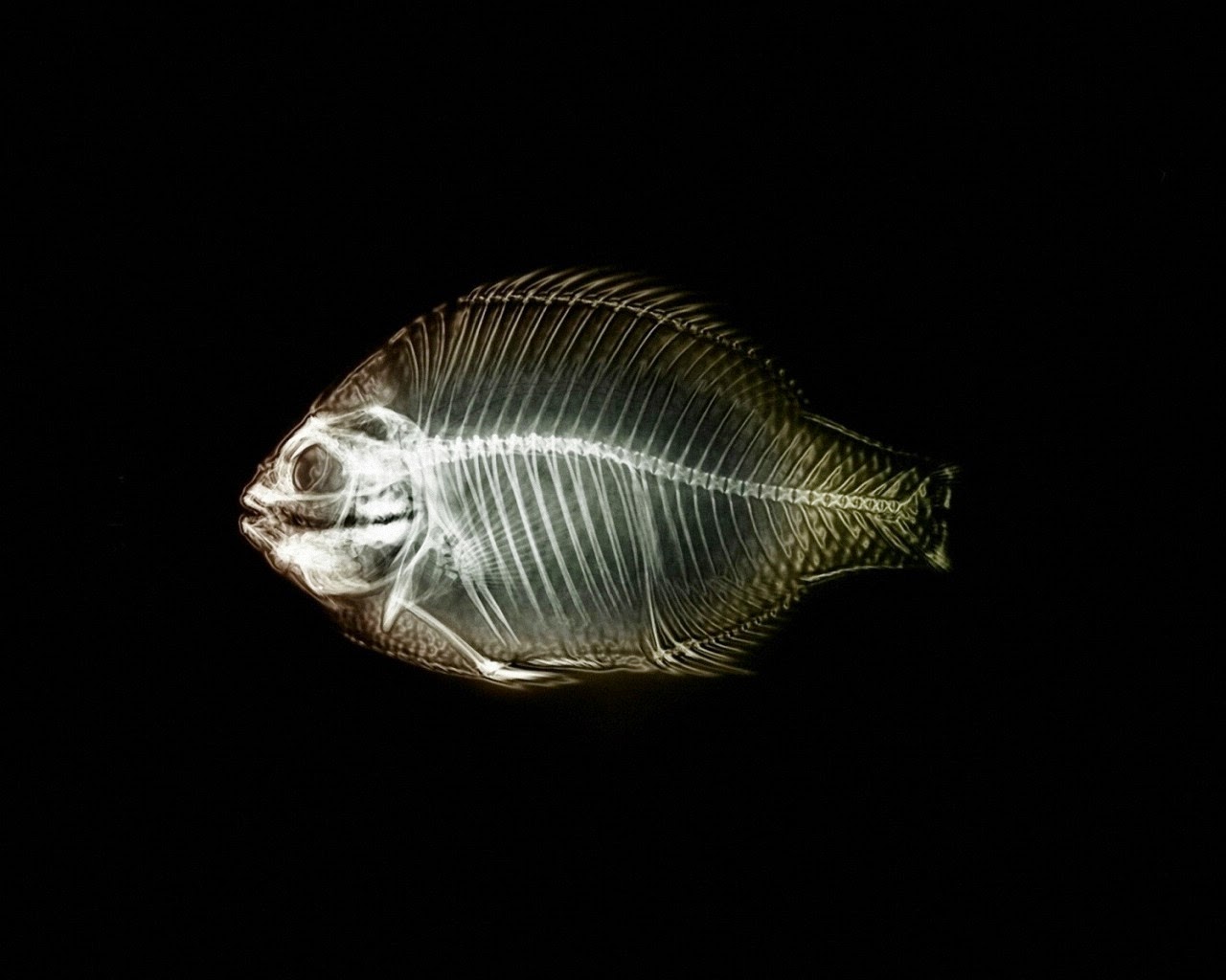 Arête De Poisson Coincée Dans L Oesophage