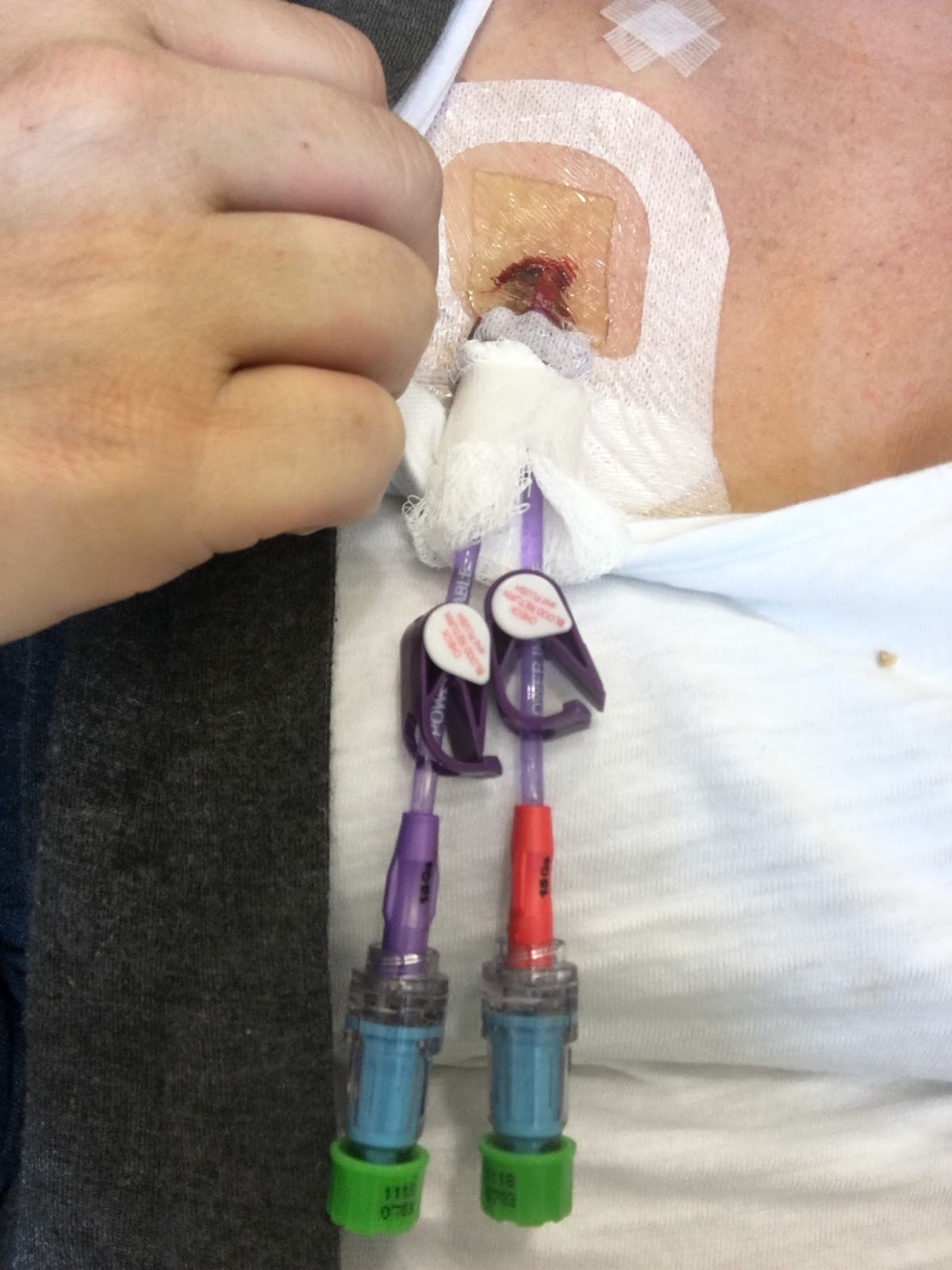 My Life As A New Mommy & Multiple Myeloma Warrior Central Venus