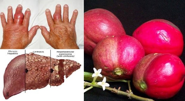 diabetes khasiat mahkota dewa untuk