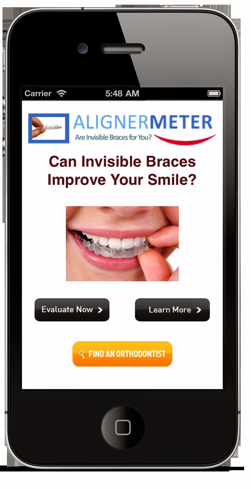 AlignerMeter The Invisible Braces App ProductReview My Mom Spark