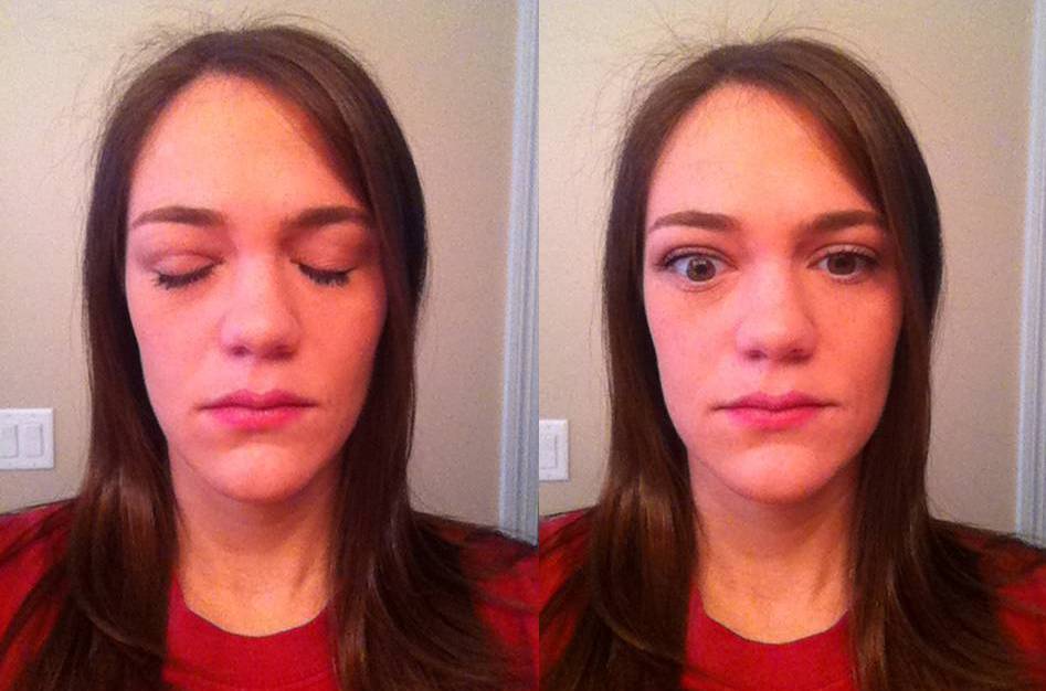 Happily Ever After MRI > Grave's Eye Disease