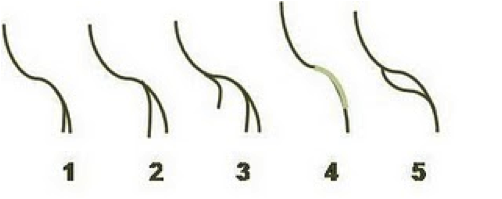 hair split ends, natural hair, hair breakage, hair loss
