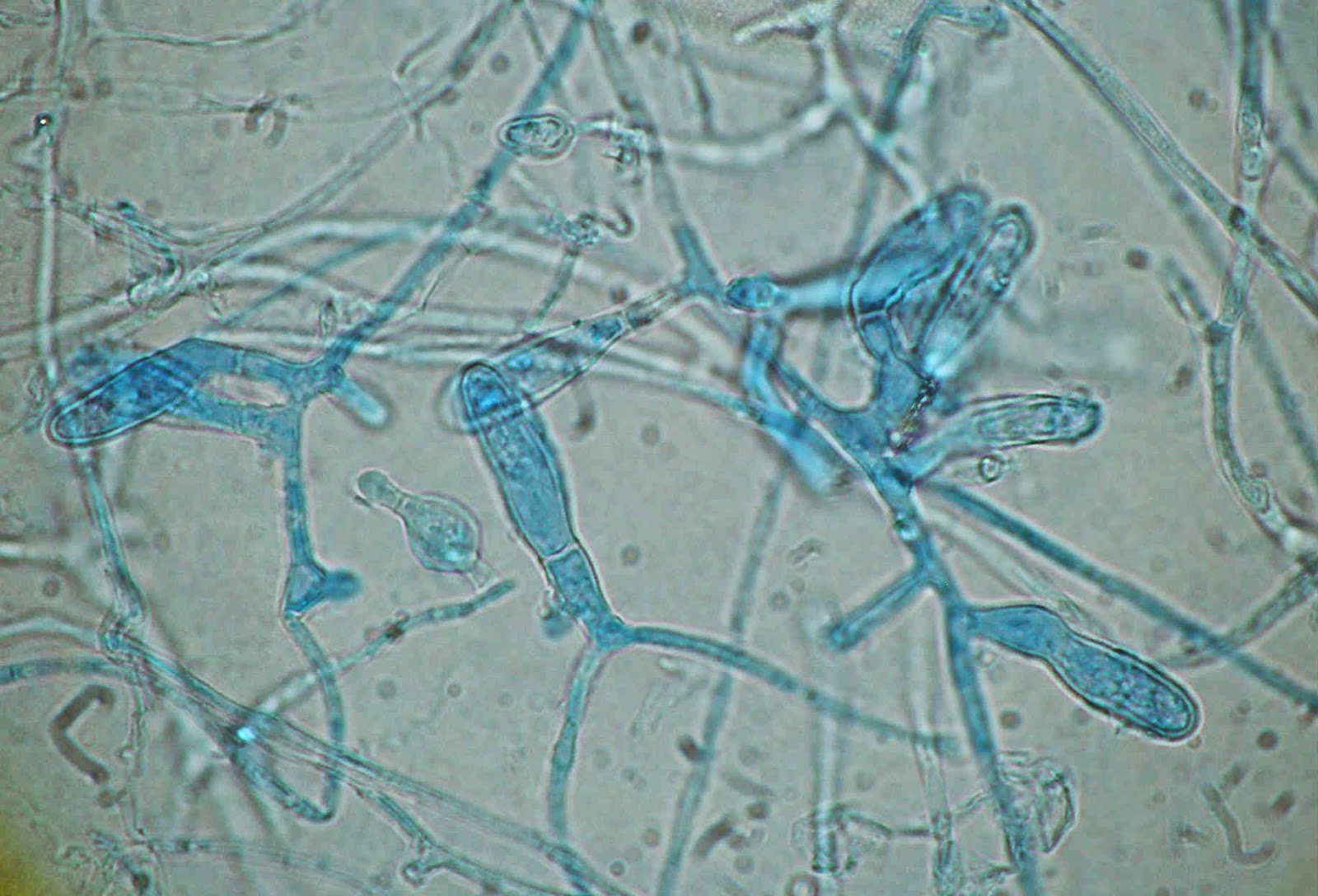 Trichophyton микроскопия