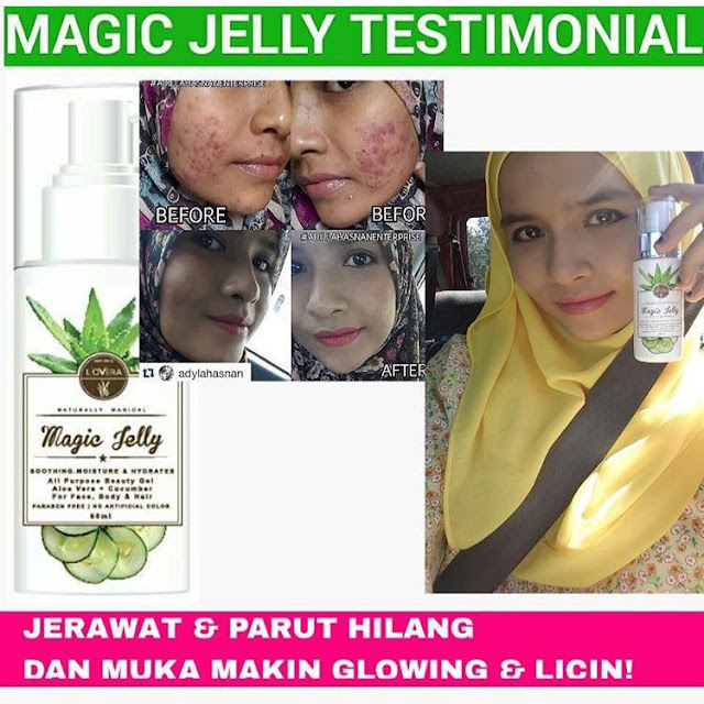 Magic Jelly Lovera Berkesan Untuk Mengurangkan Kelemumur 