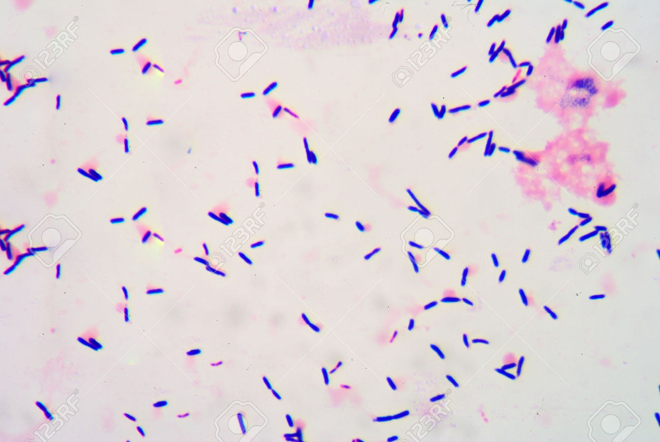 Lactobacillus spp у мужчин. Bacillus subtilis споры. Грамположительные палочки. Коринебактерии.. Грамположительные палочковидные бактерии. Лактобациллы грамположительные.