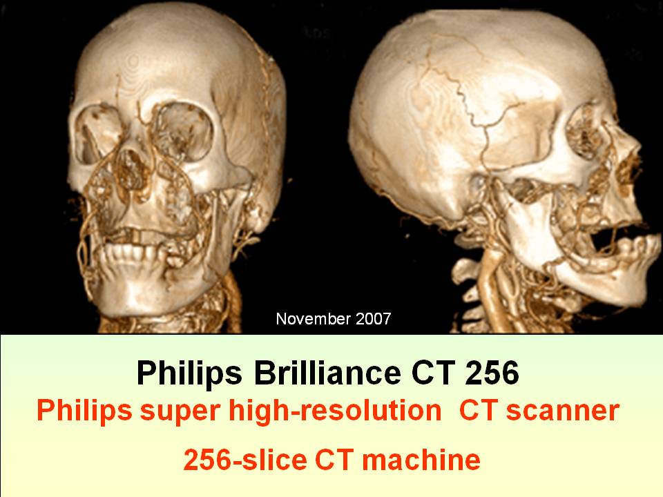 Исследования магнитно-резонансной томографии - ГАУЗ БОКД