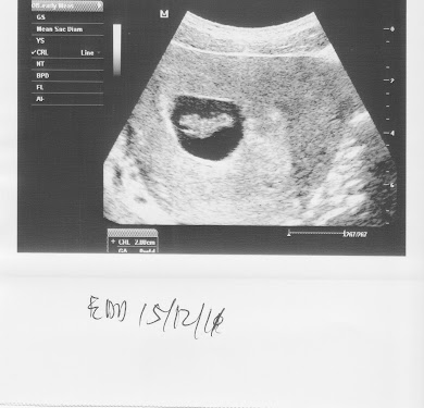 Baby~8 weeks & 4 days