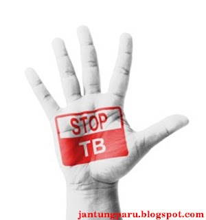Pengobatan TB paru