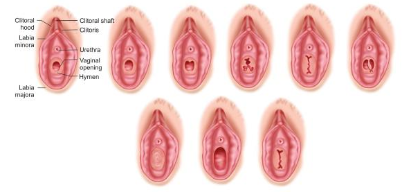 Gambar Vagina Virgin 46