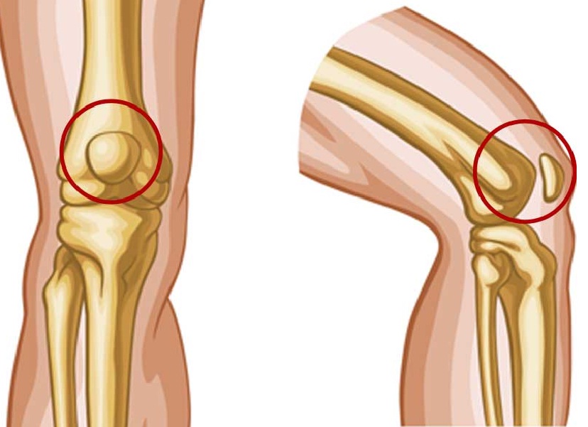 Daftar Tulang Di Area Tungkai Manusia - SECANGKIR TERAPI