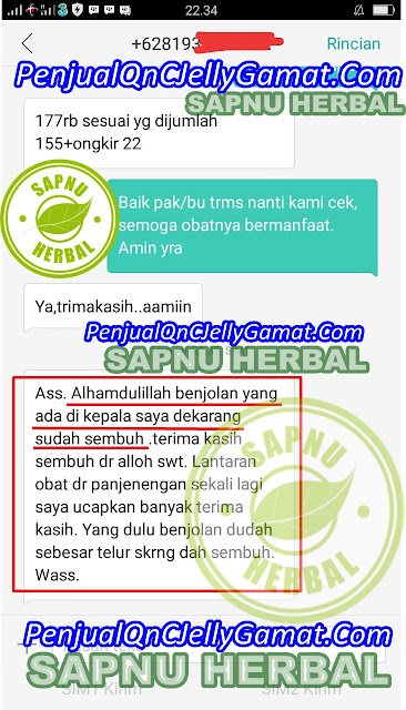 Obat Tradisional Benjolan Di Pinggang Terampuh, Terbukti Sangat Manjur!! Obat Tradisional Benjolan Di Pinggang Terampuh, Terbukti Sangat Manjur!!