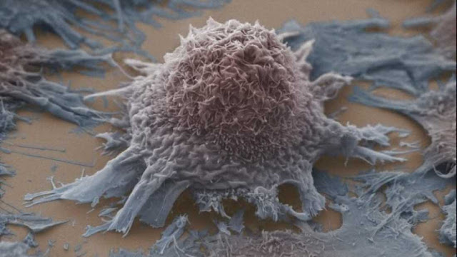 دراسة تكشف عن أن حرمان الخلايا السرطانية من السكريات قد يكون علاجًا مُستقبليًا