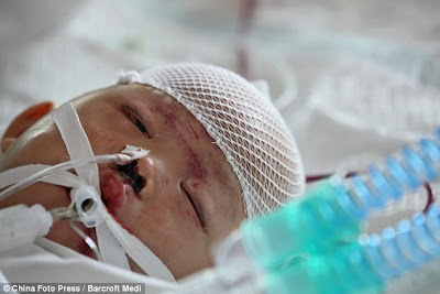 Pray for baby Yue Yue - 2 year old hit by 2 cars in China and left for dead