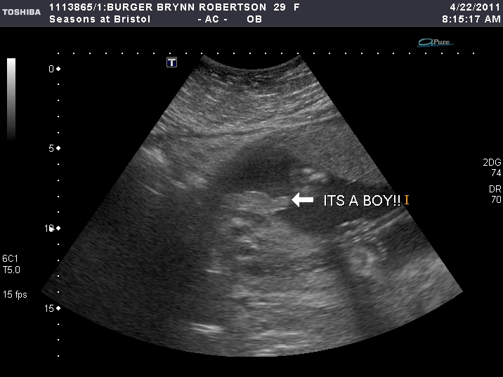 Family Pack of Burgers April 2011