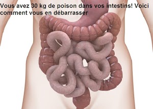 Savez-vous que vous avez environ 30 kilogrammes de Poison dans vos intestins? - Voici comment vous en débarrasser 