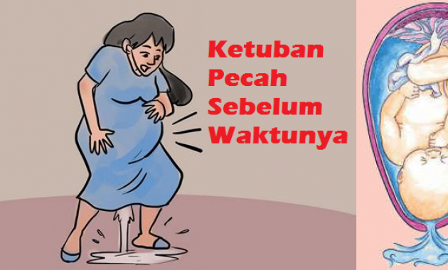MAKALAH KEBUDAYAAN IBU NIFAS DALAM SUKU TOLAKI MAKALAH KEBUDAYAAN IBU NIFAS DALAM SUKU TOLAKI