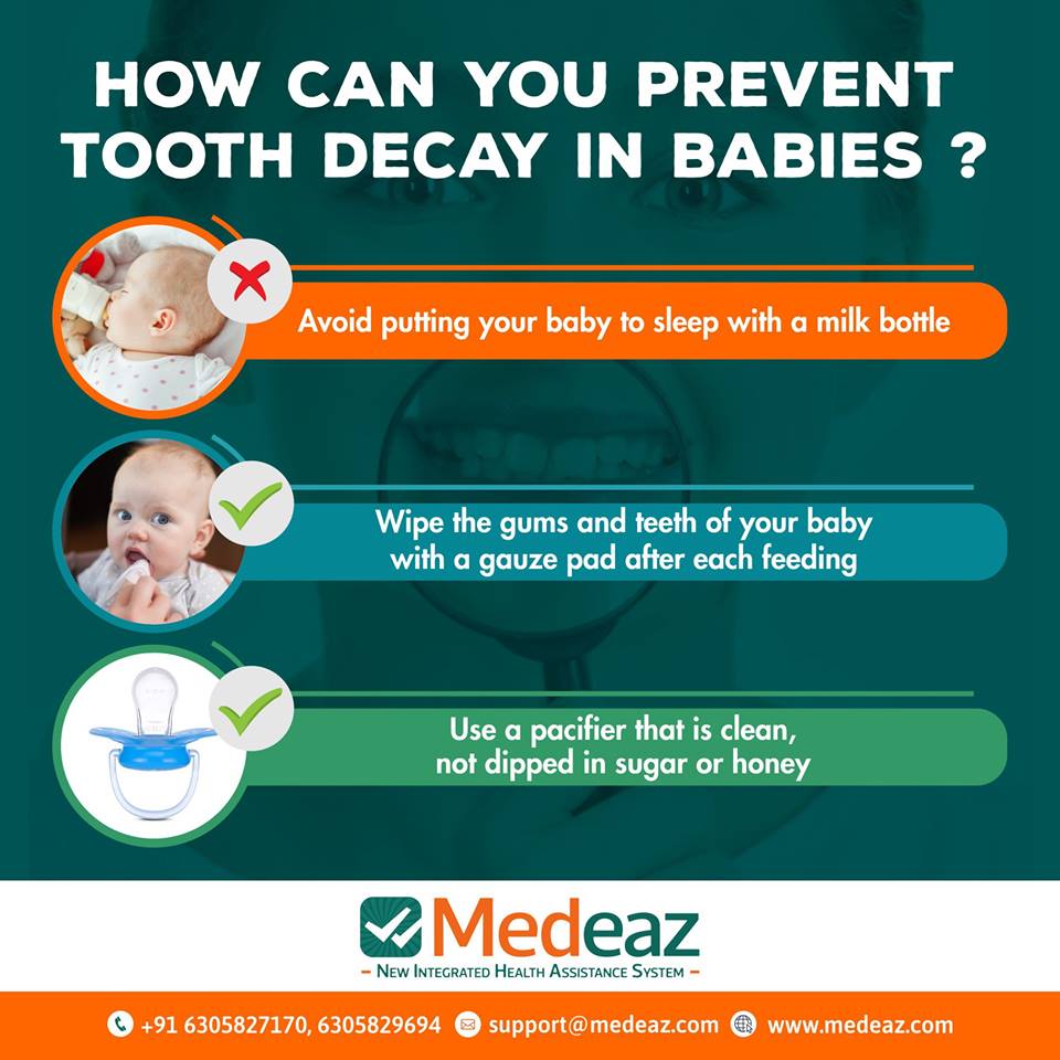 How Can You Prevent Tooth Decay in Babies?