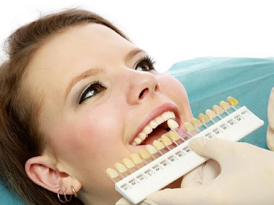 Phương pháp cải thiện răng bị hô nhẹ 