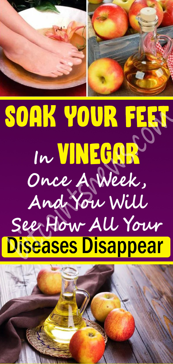 Soak Your Feet In Vinegar Once A Week, And You Will See How All Your