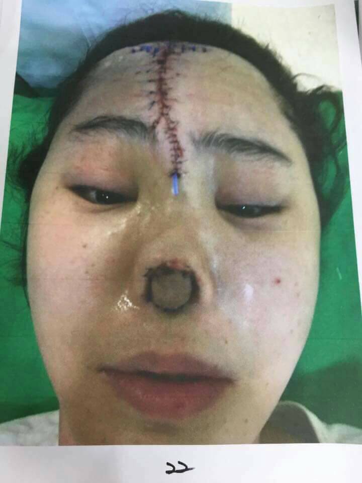 Menakutkan Belanja Rm37000 Tapi Hasil Yang Gadis Ini Dapat Dari Pembedahan Memang Sangat