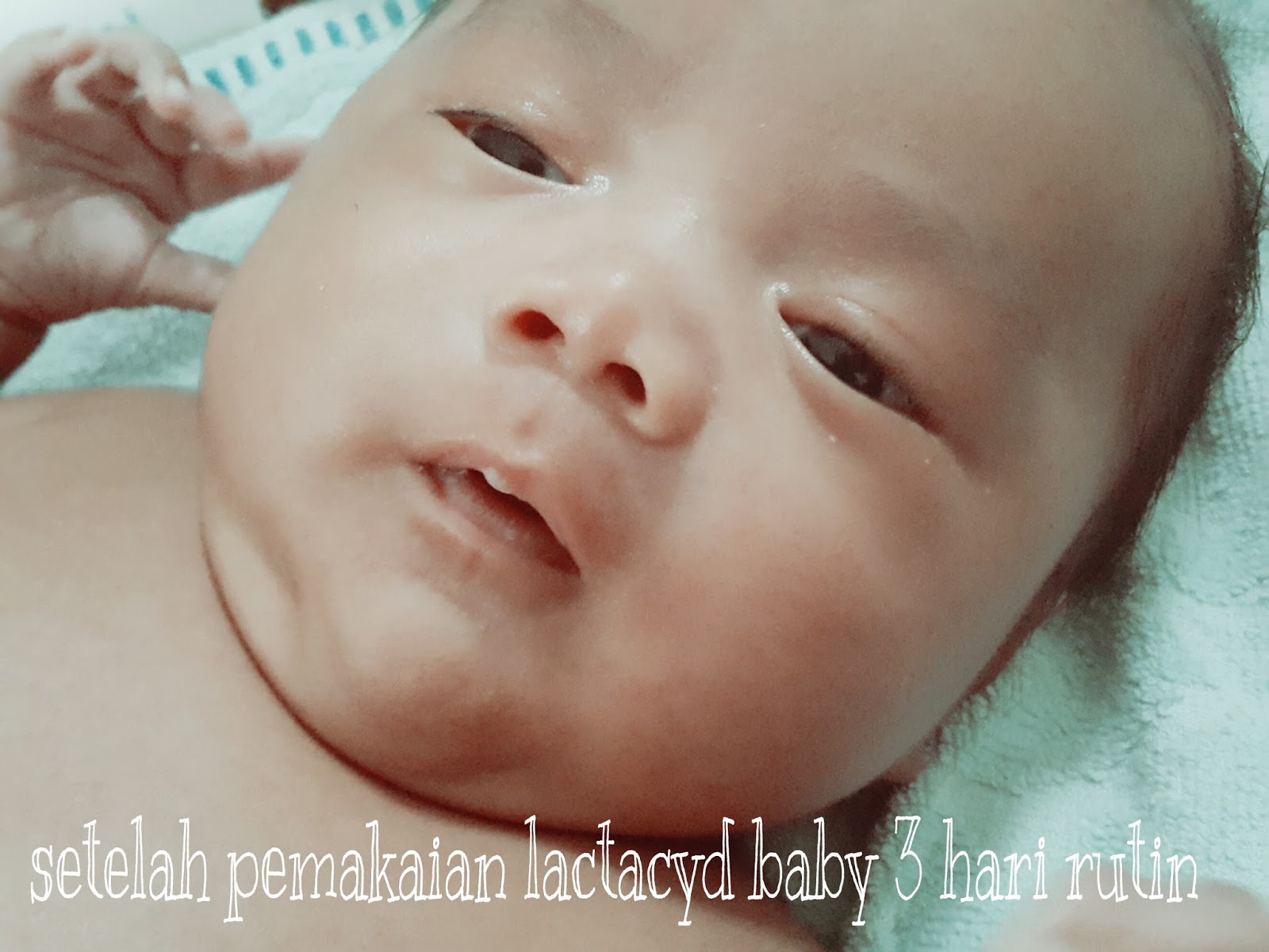 Lactacyd Baby Solusi Semua Masalah Kulit Bayi Baru Lahir Ruliretno Com