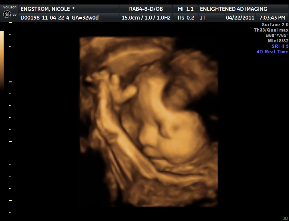 24 week 4d ultrasound pictures 24 week 4d ultrasound pictures