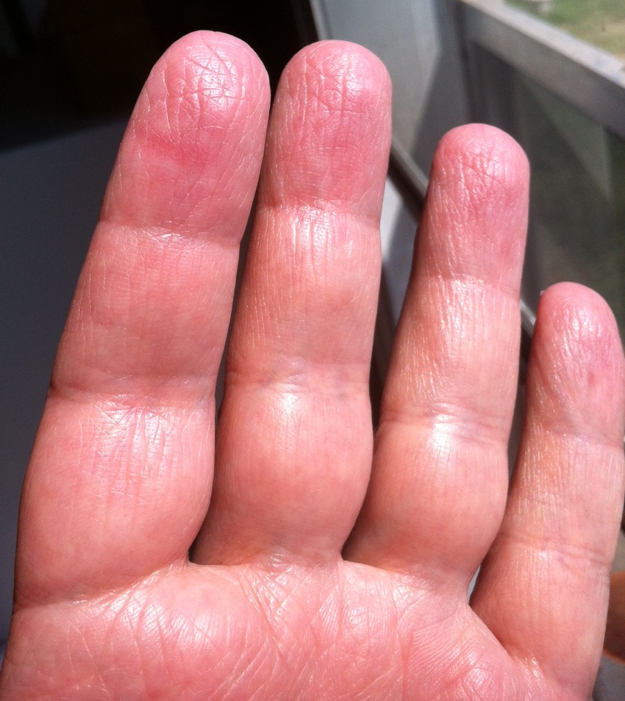 Thrilled to Death Paul Pavao's Leukemia Blog August 2012