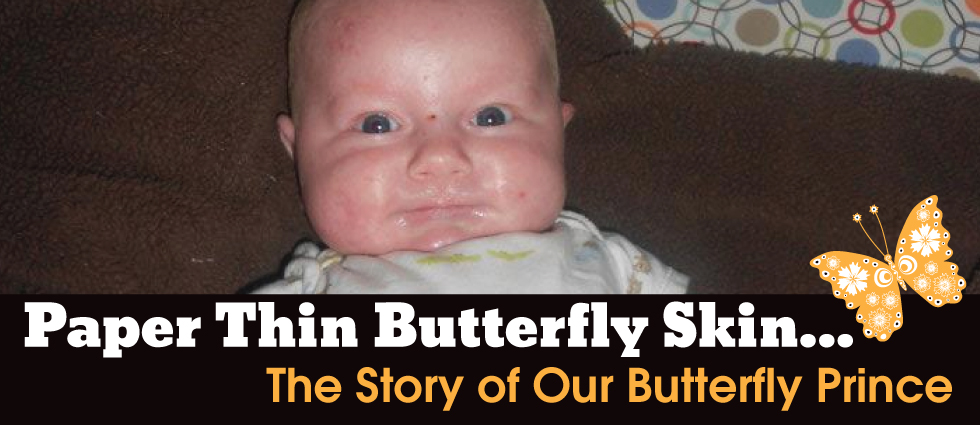 Paper Thin Butterfly Skin... The Story of Our Butterfly Prince