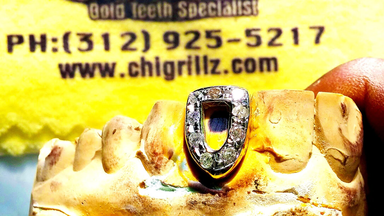 Gold Teeth Sacramento Gold Choices