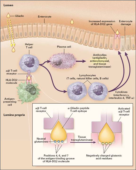 BE AWARE AND REMAIN HEALTHY Celiac Disease be-aware-and-remain-healthy-celiac-disease