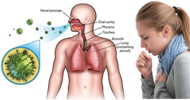 Penjelasan Lengkap Mengenai Penyakit ISPA Termasuk Gejala dan Pencegahannya