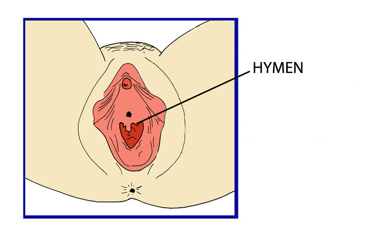 Hyman Sex 100