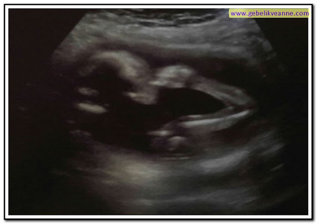 21 haftalık hamilelik (gebelik) görüntüsü
