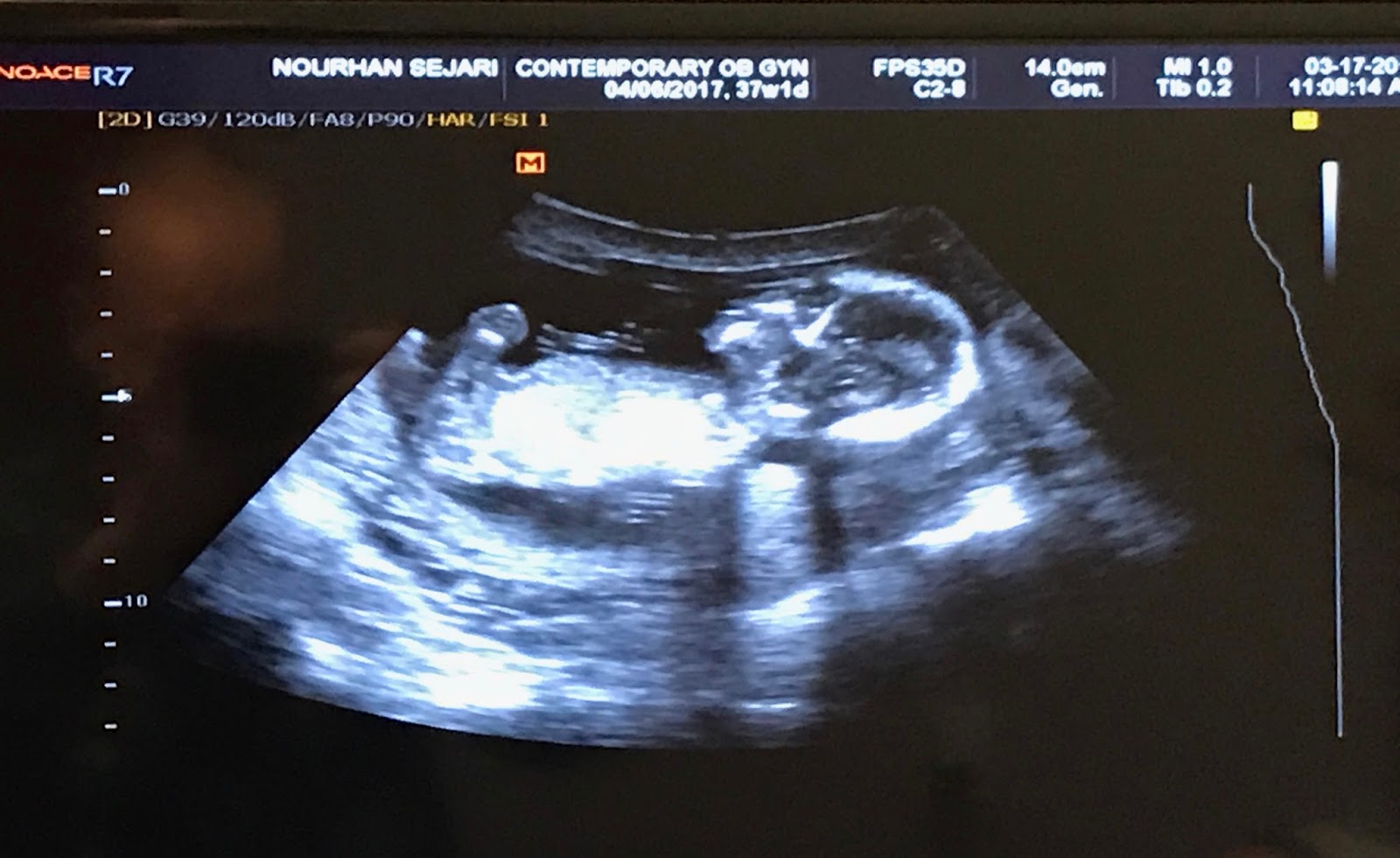 Pregnancy Update Week 1516 Our Dill Pickle, Weight Gain, and My