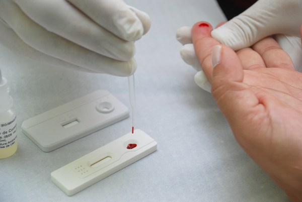 Resultado de imagem para HIV: EM SERGIPE QUASE DUAS MIL MULHERES CASADAS ESTÃO INFECTADAS