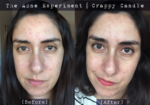 Caru Witch Hazel + Bee Balm Toner Before & After