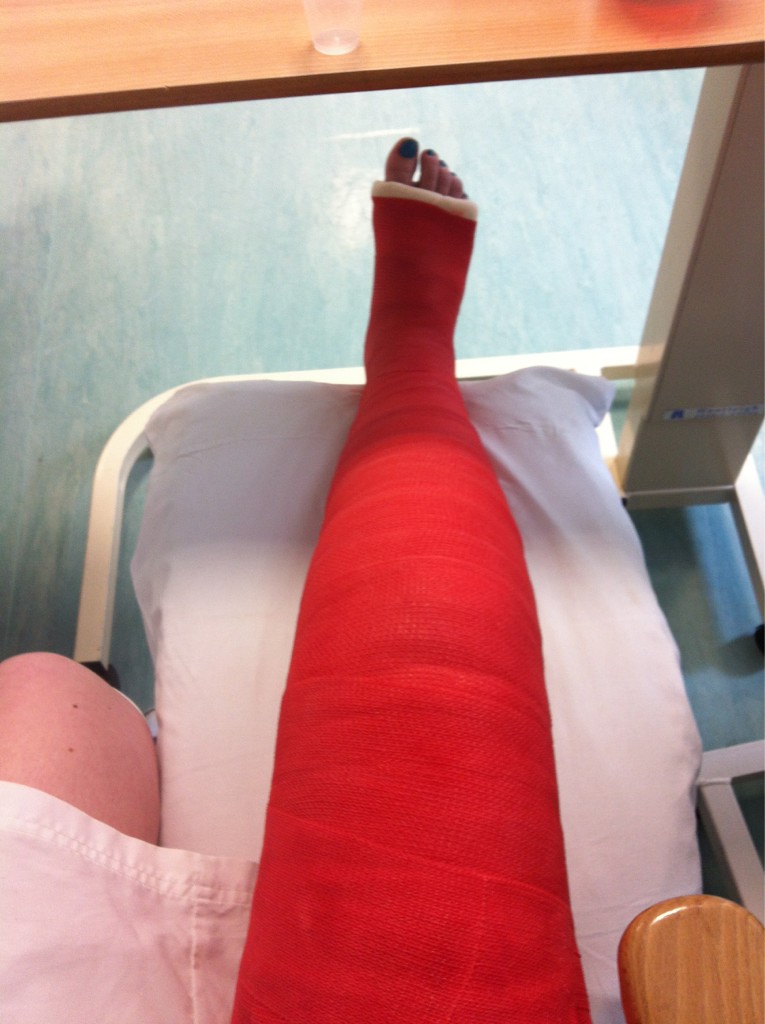 Casts and Toes Full Leg Castober Fest!