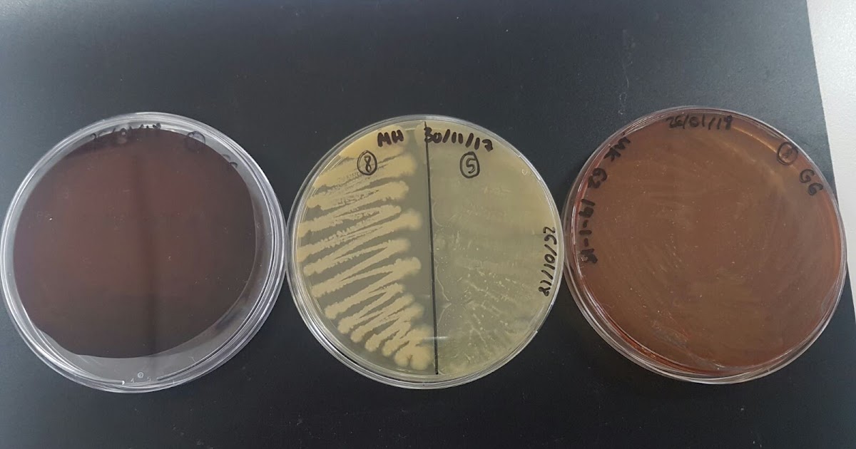 Prácticas de Microbiología Práctica 12 Siembra en placas de agar