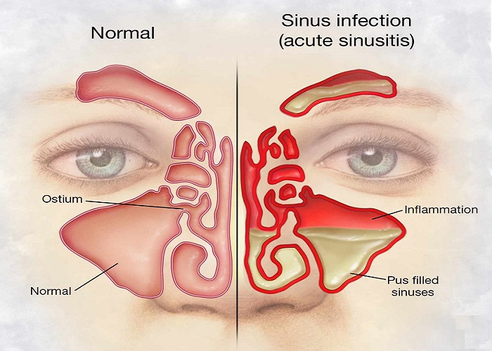 Houston Sinus Center About ENT Problems Common Reasons That Lead To