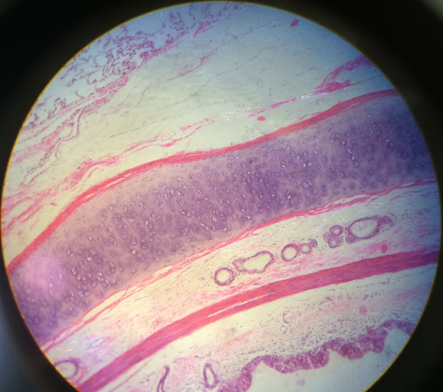 histology slide of hyaline cartilage of bronchus