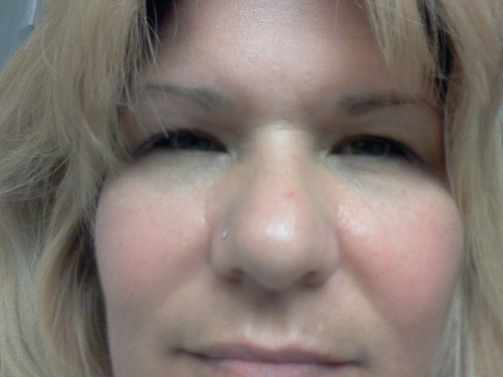 Benazepril side effects facial swelling congratulate For benazepril side effects facial swelling